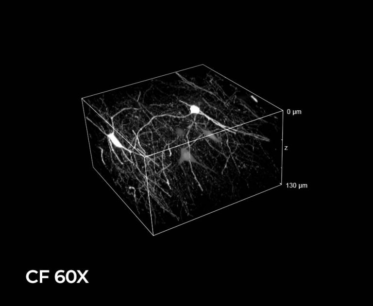 Structured illumination microscopy with low magnification objectives ...