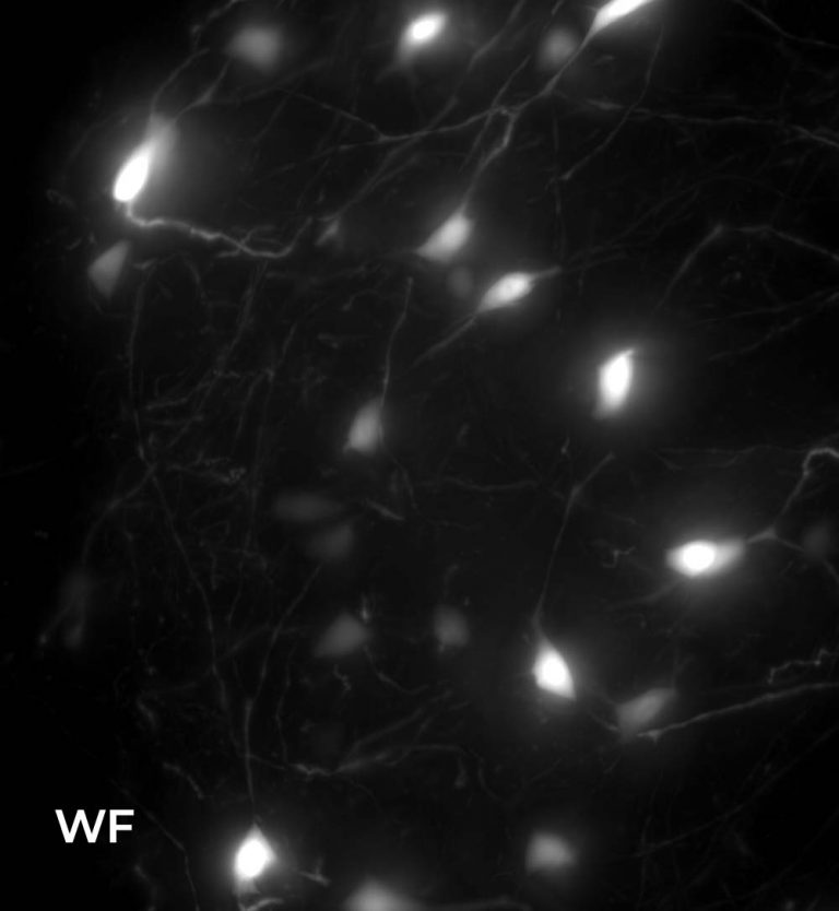 Structured illumination microscopy with low magnification objectives ...
