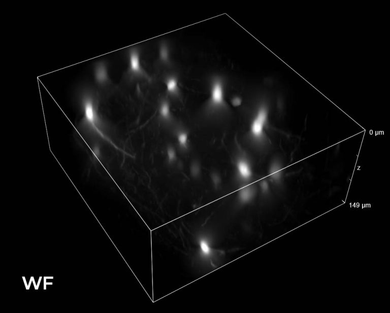 Structured illumination microscopy with low magnification objectives ...