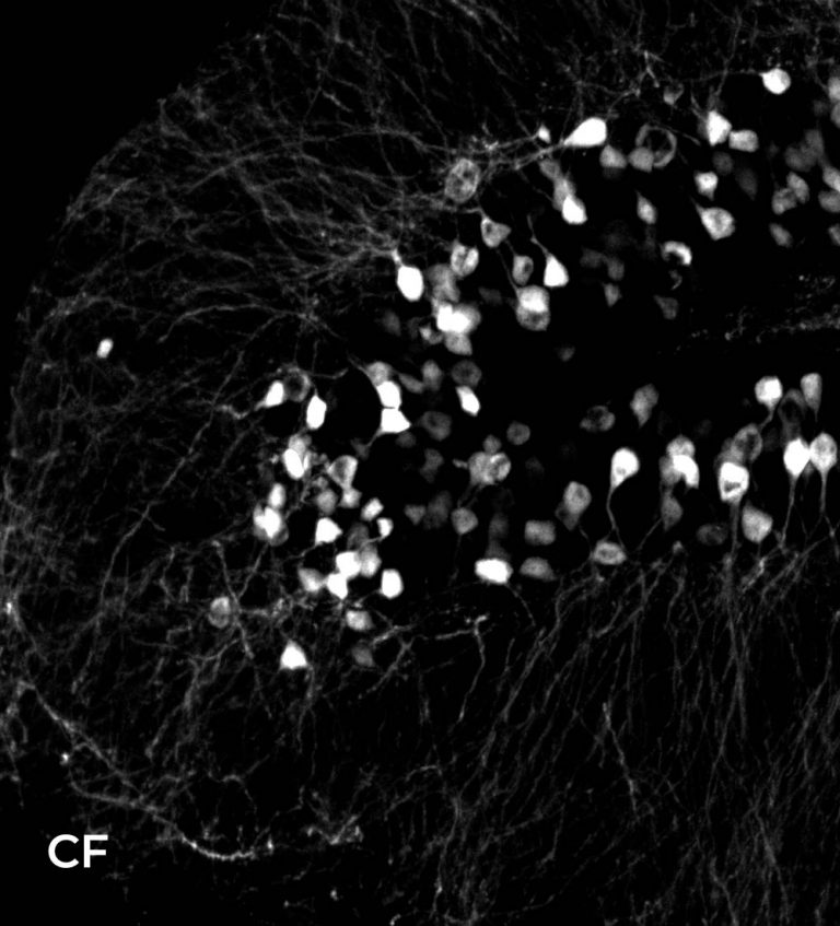 Structured illumination microscopy with low magnification objectives ...