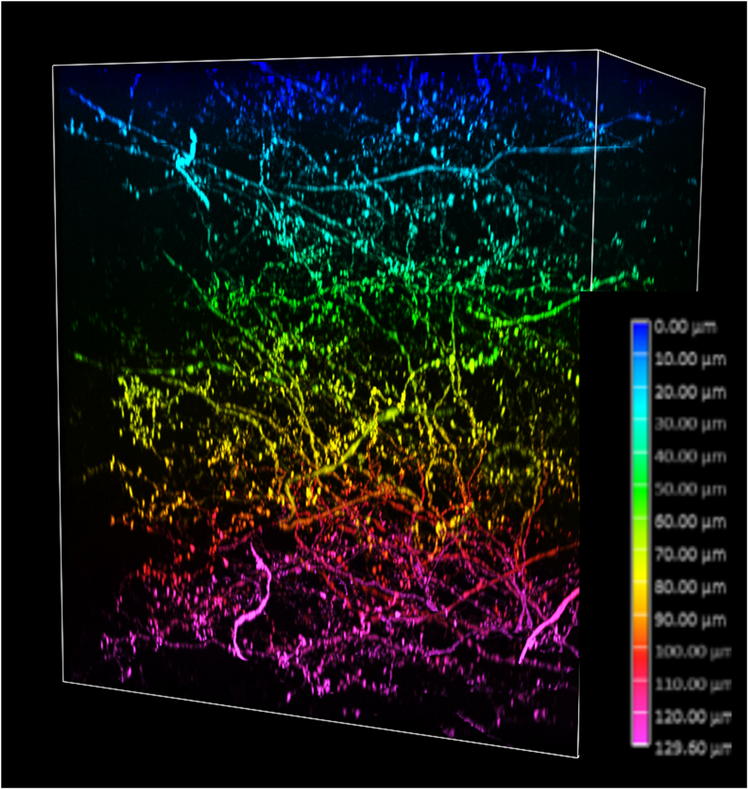 X-Light V3 + DeepSIM Multimodal Imaging Platform. - CrestOptics